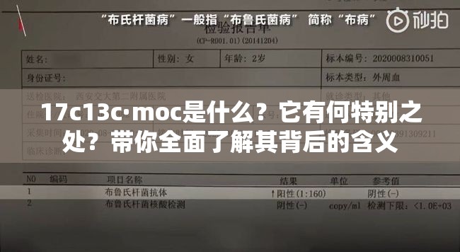 17c13c·moc是什么？它有何特别之处？带你全面了解其背后的含义