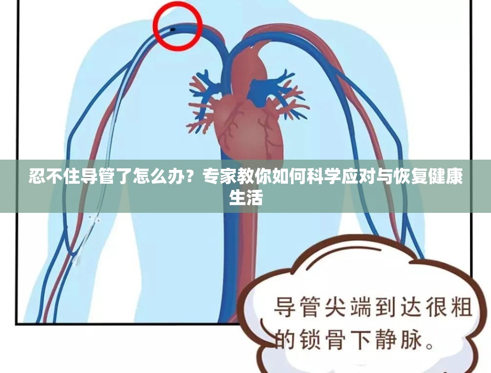 忍不住导管了怎么办？专家教你如何科学应对与恢复健康生活